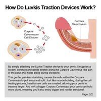 Penis Extender Enlargement System Enlarger Stretcher Enhancement Vagina Sex - Image 4